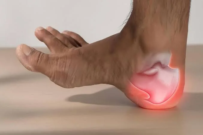 Illustration highlighting the heel and underside of the foot to indicate heel pain.