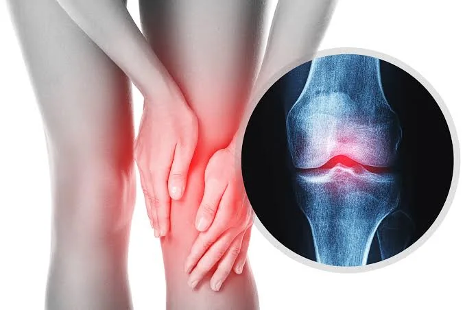 Illustration of a person holding a painful knee alongside a knee-joint scan.